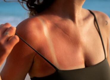 La planta natural que alivia quemaduras tras la exposición solar; contiene propiedades regenerativas