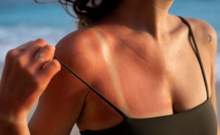 La hoja mágica que trata quemaduras solares, y mejora la cicatrización de heridas sin dejar cicatrices