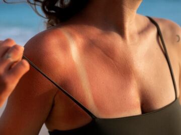 La hoja mágica que trata quemaduras solares, y mejora la cicatrización de heridas sin dejar cicatrices