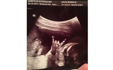 Ultrasonido muestra a "bebé listo para rockear"; imagen se hace viral