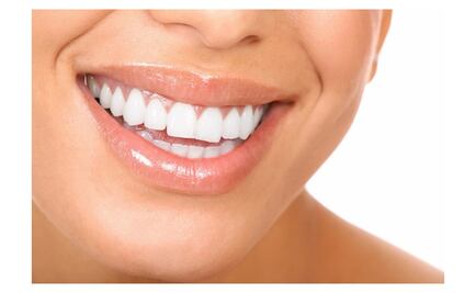 Blanquea tus dientes en cinco pasos 