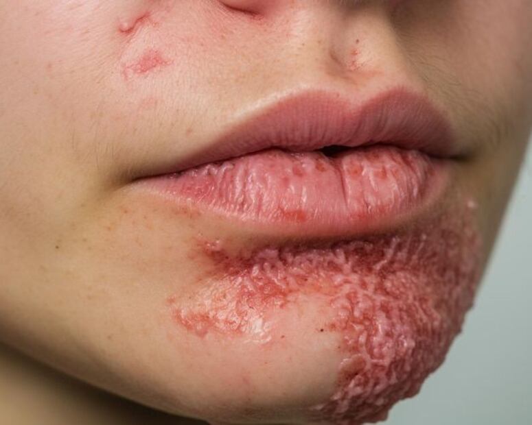 Desentrañando el misterio del sarpullido. Fuente: Freepik.