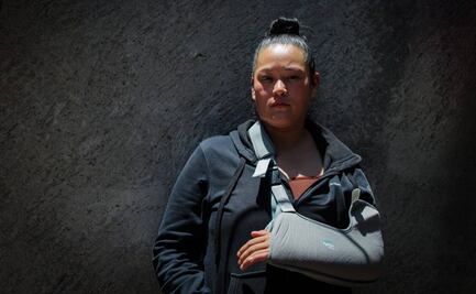 Alejandra Suárez recibió 9 disparos y no se investiga como intento de feminicidio; “no me mató, pero me quitó la tranquilidad”