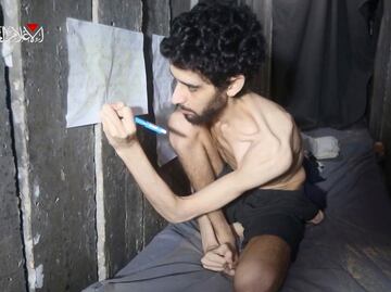 "Es un esqueleto humano. Necesita tratamiento o morirá": habla hermano de rehén de Hamas que aparece cavando su tumba