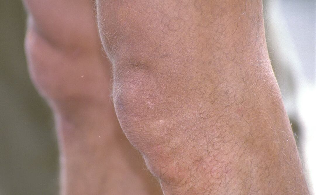 Foto: Archivo El Universal