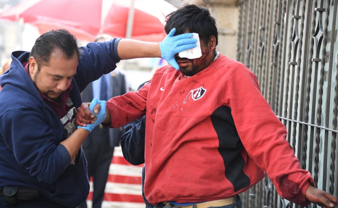 (Foto: Eduardo Sánchez/El Gráfico)