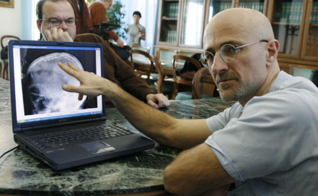 El neurocirujano italiano Sergio Canavero  realizará la intervención. (FOTO: Archivo/EL UNIVERSAL)