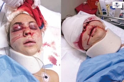 Famosas que dan el perdón a agresores