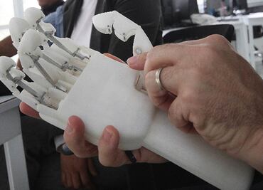 Niño francés recibe prótesis hecha con impresora 3D