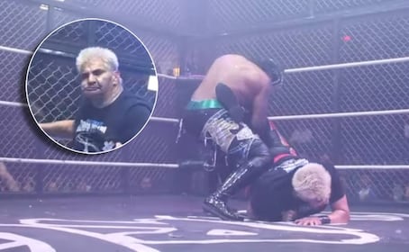 Shocker: El Mil por Ciento Guapo sufre cambió de 'look' ante el rival que le desfiguró el rostro