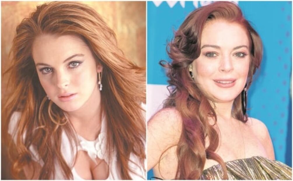 Famosos que recurren a la cirugía estética para ser mejores