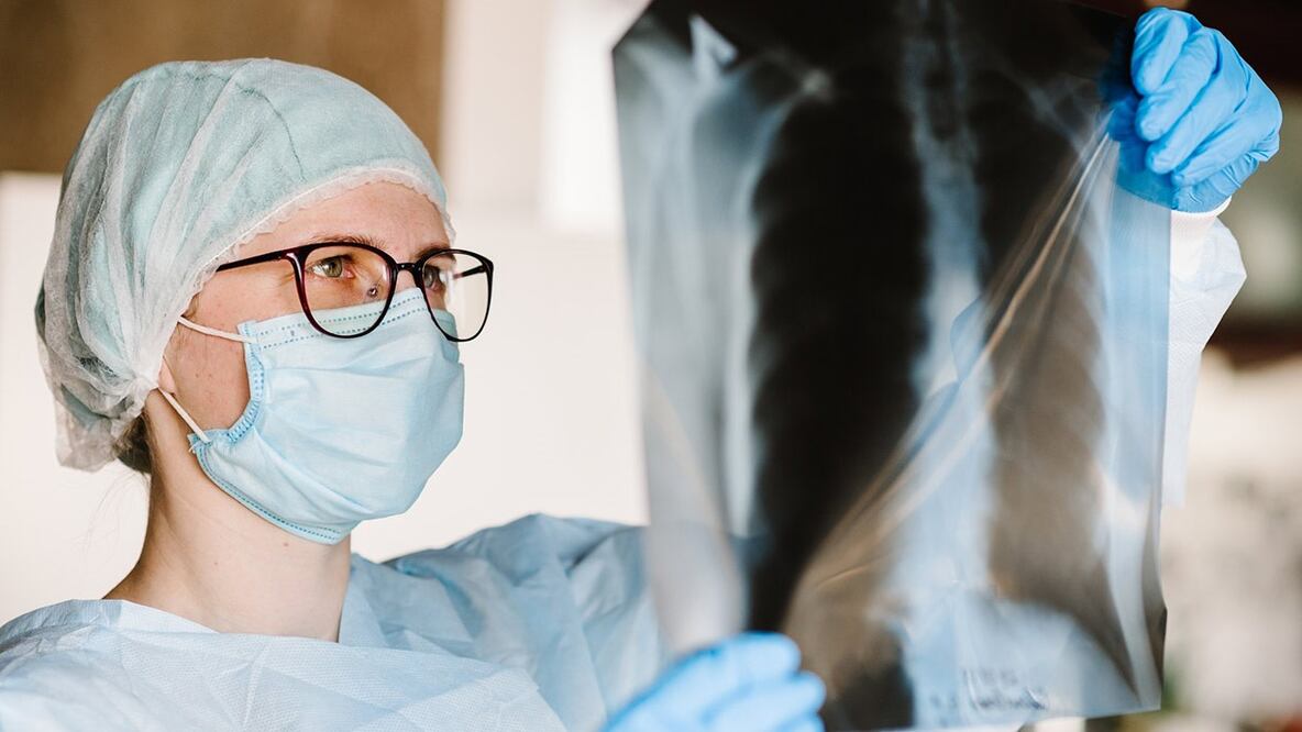 Secuelas del Covid-19