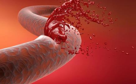 La hemofilia, el mal de la realeza que solo afecta a los hombres