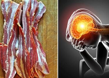Hombre acude al hospital por migraña; le encuentran larvas en el cerebro tras comer tocino