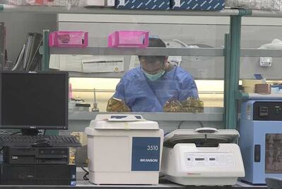 Eliminan VIH en seis pacientes con trasplante de células madre