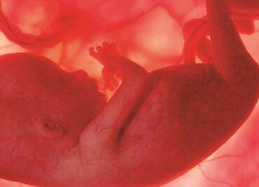 Entérate. ¿Qué es la espalda bífida?