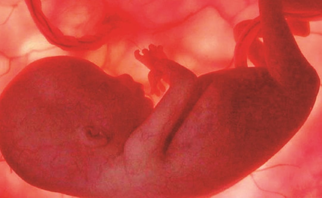 Entérate. ¿Qué es la espalda bífida?