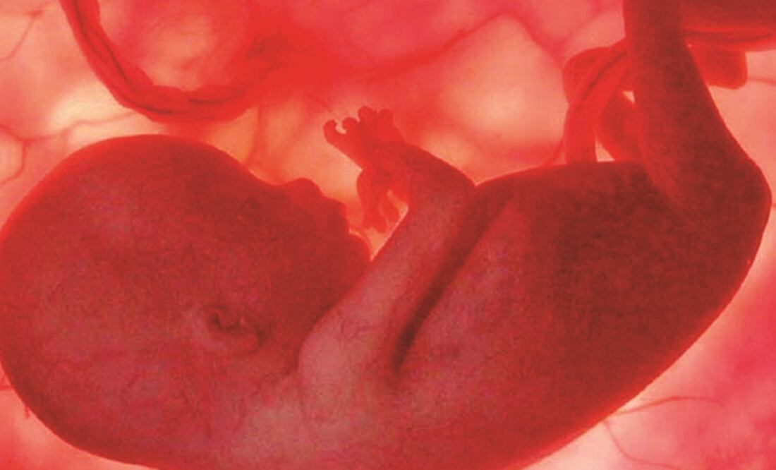 Entérate. ¿Qué es la espalda bífida?