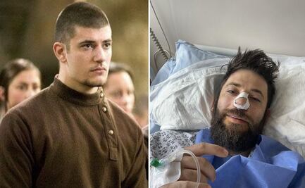 Actor de "Harry Potter" es operado de emergencia; sufre fuerte crisis respiratoria 