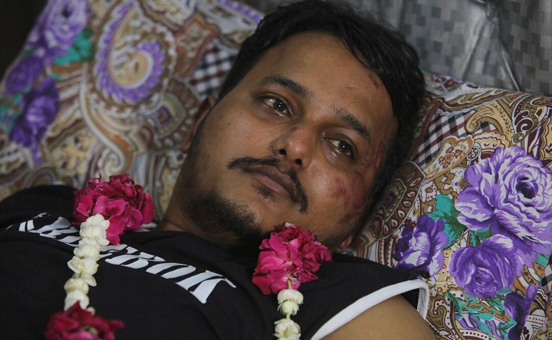 Mohamad Zubair, uno de los dos supervivientes del accidente ocurrido ayer en Pakistán. Foto: AP