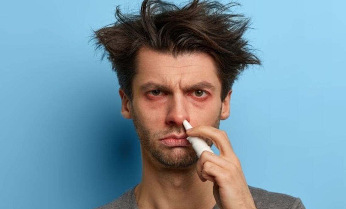 La mayoría de las sinusitis desaparecen solas y no requieren antibióticos. Fuente: Freepik.