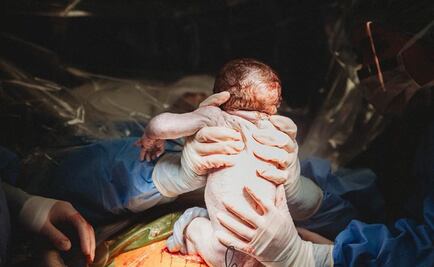 Partera de Kentucky participa en el nacimiento, por cesárea, de su propio hijo