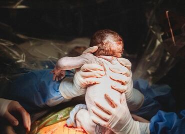 Partera de Kentucky participa en el nacimiento, por cesárea, de su propio hijo