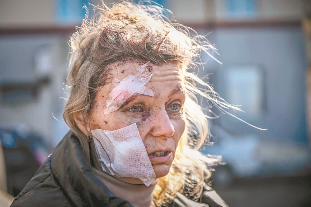 Olena Kurilo, herida frente a un hospital después del bombardeo de la ciudad de Chuguev, en el este de Ucrania. Foto: AFP