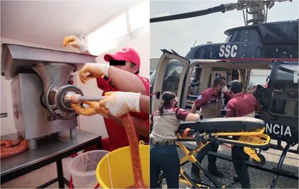 Adolescente sufre amputación de una mano por molino de carne en Iztapalapa; Cóndores lo trasladan a hospital 