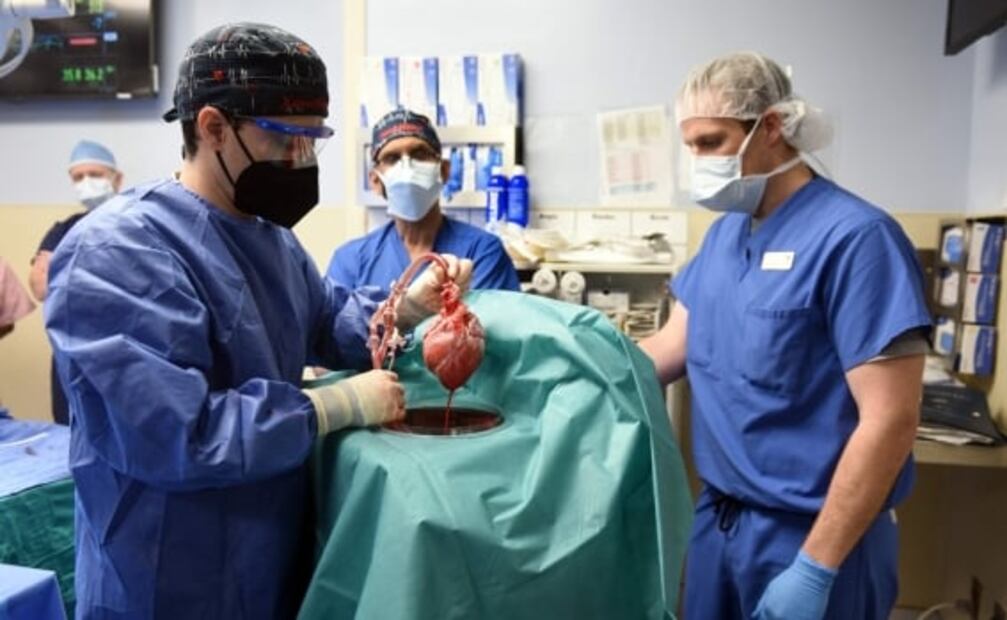 Muere paciente que vivía con un corazón de cerdo 