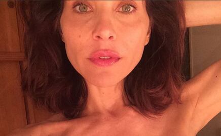 Lorena Meritano muestra cicatrices de lucha contra el cáncer