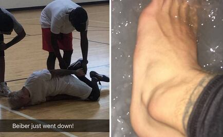 Justin Bieber se lesiona jugando basquetbol