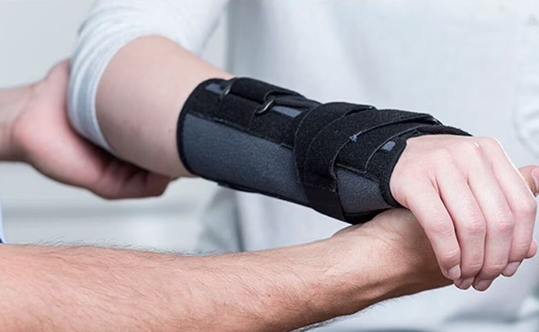 Cada año se producen alrededor de 9 millones de fracturas con un enorme impacto en los pacientes. Foto: EL UNIVERSAL