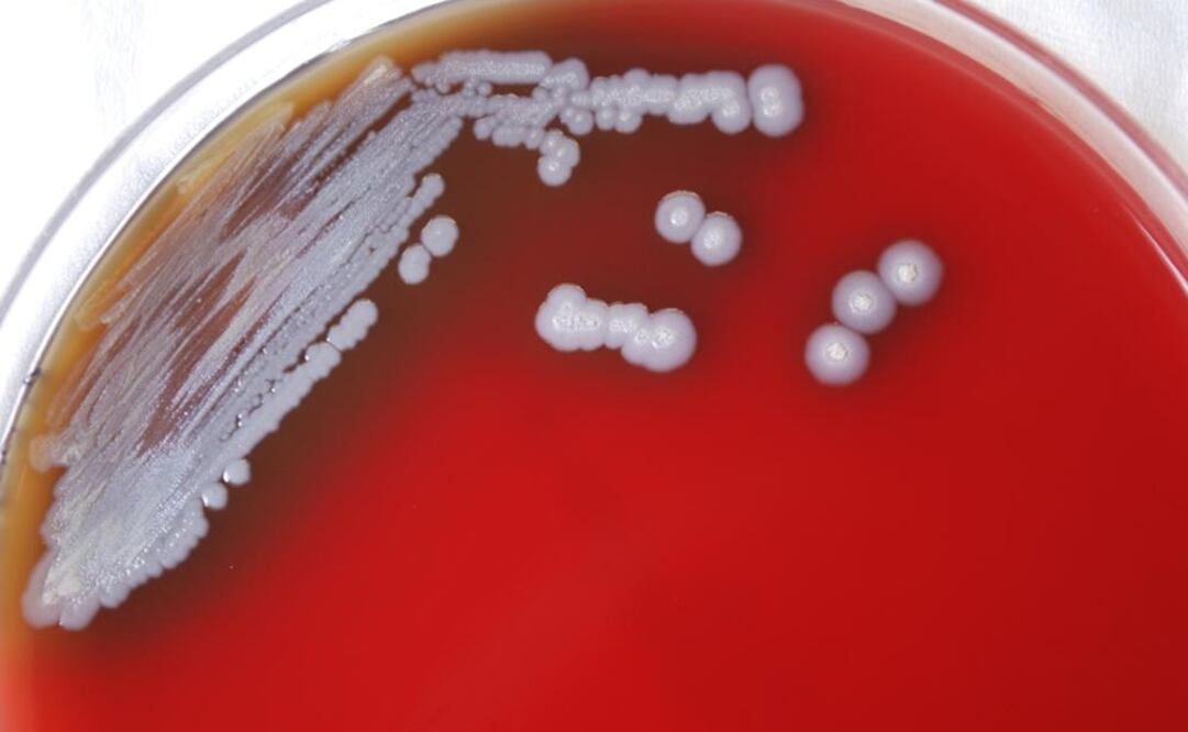 Placa de Petri que contiene varias colonias de bacterias gramnegativas Burkholderia pseudomallei. Foto: AP