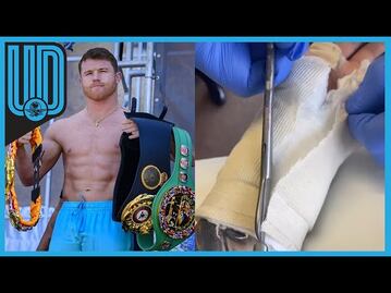 Canelo Álvarez compartió cómo quedó su mano tras cirugía que lo alejaría del boxeo