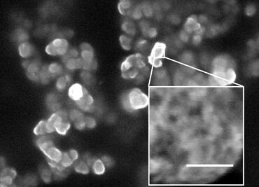 Las nanopartículas contrarrestan efectos de quimioterapia