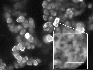 Las nanopartículas contrarrestan efectos de quimioterapia