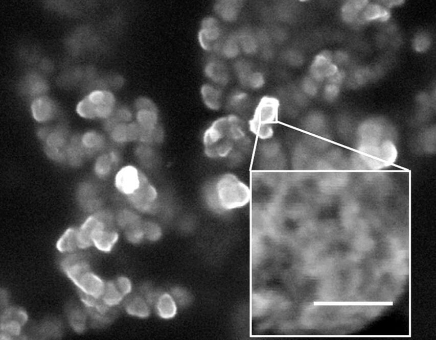 La palabra nanopartícula está compuesta por el prefijo griego “nano” que significa “enano”. (FOTO:Archivo/EL UNIVERSAL)