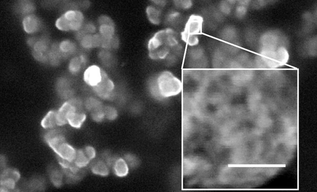 La palabra nanopartícula está compuesta por el prefijo griego “nano” que significa “enano”. (FOTO:Archivo/EL UNIVERSAL)