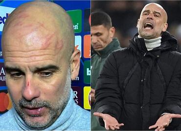 Pep Guardiola rompió el silencio sobre los rasguños que se hizo en la cara: Hay que buscar ayuda