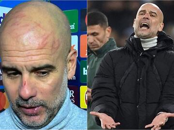 Pep Guardiola rompió el silencio sobre los rasguños que se hizo en la cara: Hay que buscar ayuda