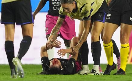 Charlyn Corral sufre escalofriante herida en Duelo de Estrellas vs Barcelona; seré intervenida quirúrgicamente 