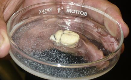 Estudian los efectos de las anfetaminas en las neuronas