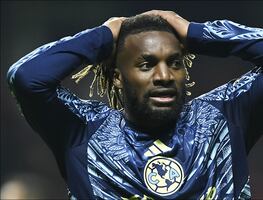 América no demuestra querer el súperliderato y pierde con un poderoso Toluca