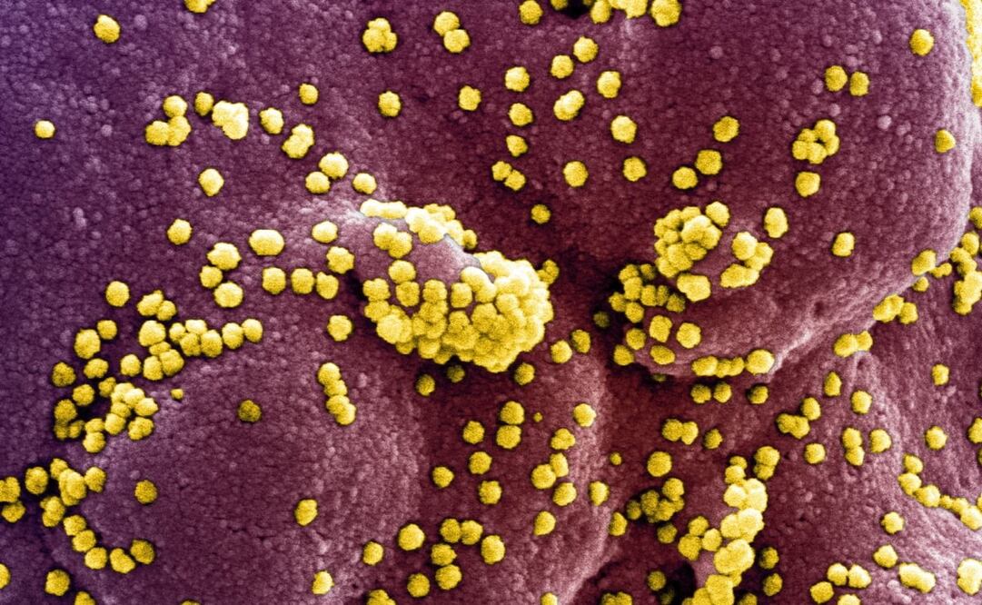 Foto: EFE/EPA/NIAID/NATIONAL INSTITUTES OF HEALTH 