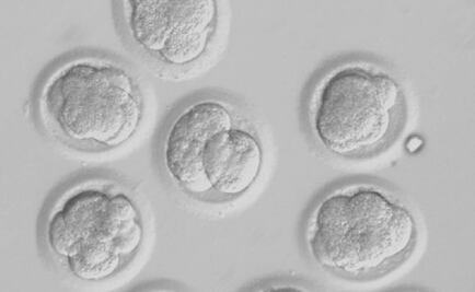 Investigadores de la UNAM descubren nuevo método contra el Parkinson