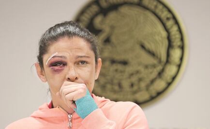 Reprueba obispo de San Cristóbal agresión contra Ana Guevara