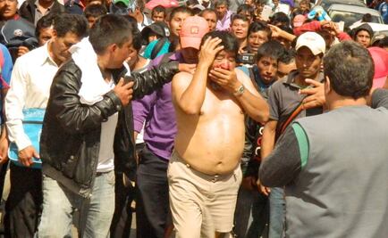 Dan de alta a ex edil de Oxchuc que fue agredido