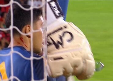 VIDEO: Violencia en Argentina; portero de Boca Juniors sufre corte en el cuello por un vidrio lanzado por hinchas de Newell's