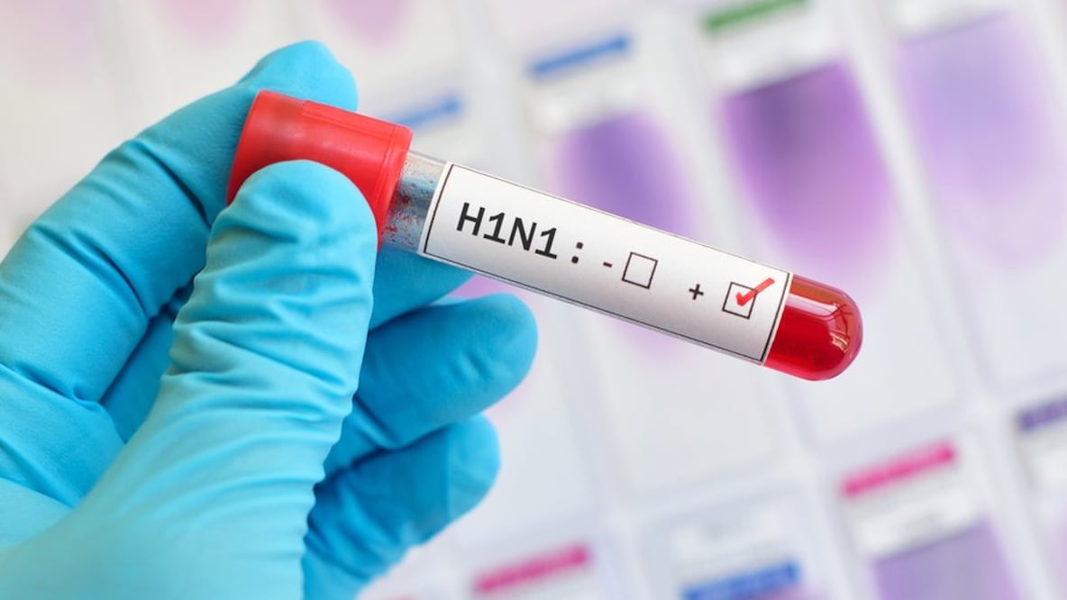 La pandemia de H1N1 afectó a más de 200 países entre 2009 y 2010. Foto: Getty Images